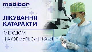 Лікування катаракти методом факоемульсифікації