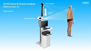 DIERS formetric 4D - How it works (EN)