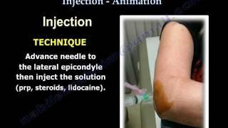 Tennis Elbow Lateral Epicondylitis Injection - Everything You Need To Know - Dr. Nabil Ebraheim