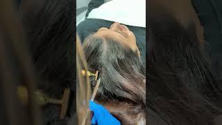 Hair PRP | First session | Know all about it from our customer | PRP REVIEW