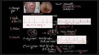 Traitement de l'hypertension artérielle - Guidelines - Exercices - HTA - Docteur Synapse