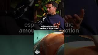 Compression after Liposuction