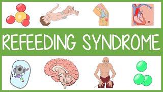 Refeeding Syndrome