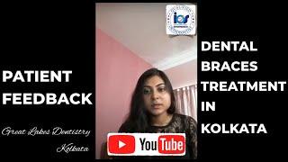 Dental braces before and after | time lapse | Best Braces Dentist in Kolkata | Best Orthodontist