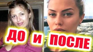 УЧАСТНИКИ ДОМ-2 ДО И ПОСЛЕ ПЛАСТИКИ