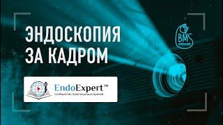 EndoExpert.ru: кто стоит за кадром, ошибки онлайн-трансляций, альфа-спикеры и  кто такой Скопыч?