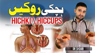 Hichki Kaise Band Kare || Hiccups Treatment in Urdu/Hindi