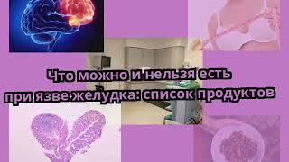 Что можно и нельзя есть при язве желудка: список продуктов