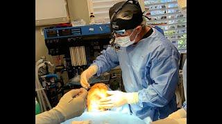 My Ellevate and Tightening of The Neck by Dr. Gregory Casey ~ Way to Improve the Neck Angle