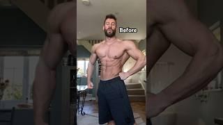Gaining 10lbs in 3 days from water retention