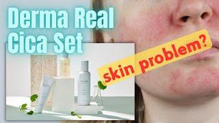 Atomy Derma Real Cica | Effective Skincare Solutions for Problematic Skin