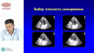 Эхокардиография в диагностике и ведении пороков митрального клапана сердца