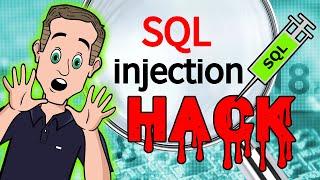 SQL Injection