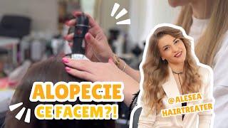 Alopecie | Alesea Hairtreater