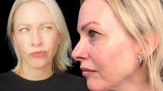 ROSACEA & RETINOL ?? How to use retinol with rosacea skin