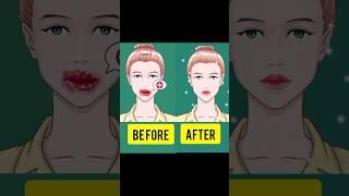 #asmr treatment animation #shortvideo #youtubeshorts #shorts #viral