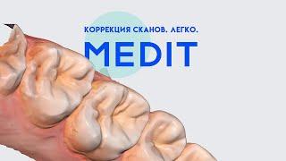 КОРРЕКЦИЯ СКАНОВ. ЛЕГКО. MEDIT | ARTICON