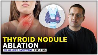 THYROID NODULE TREATMENT WITHOUT SURGERY | THYROID RFA | Dr. Gaurav Gangwani