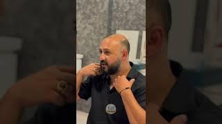 Lifetime Hair Transplant