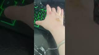 Hehe f you