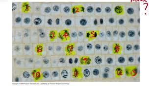 IB Biology Tutorial - 1.6 - Mitotic Index