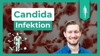 Candida: DAS solltest Du unbedingt wissen! | Darm | Paul Seelhorst