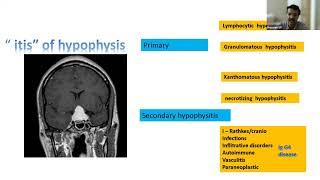 HYPOPHYSITIS ESB, 4E WEBINAR, 29.10.21