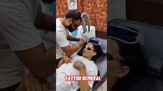 Face Tattoo removal #tattoo #tattooremoval #remove #tattooart #tattooartist #tattoodesign