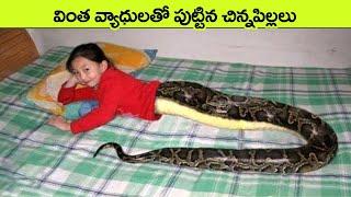  వింతగా పుట్టిన 10 మంది పిల్లలు | 10 Kids Who Are Only Born Once in a Thousand Years |unique people