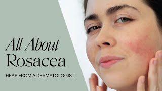 All about Rosacea | According to a Dermatologist