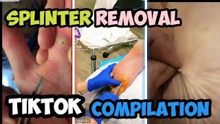 Splinter Removal | TikTok COMPILATION Videos ️