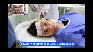 Fransız Askısı.Şarkıcı NEZ Hanımada Fransız Askısı Deep Lifting Yaptık   #estetik #fransızaskısı