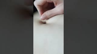 belly button needle stab