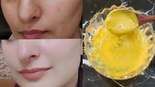 100% Challenge To Get Fair Skin in Just 1 Night / Get Glowing Spotless Bright Skin