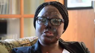 Hanifa Nakiryowa: Survivor of Acid Violence