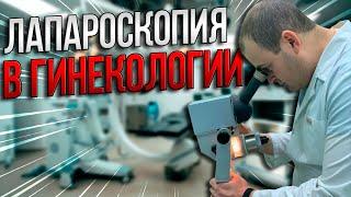 Лапароскопия в гинекологии: за и против. Оводенко Дмитрий Леонидович. Москва.