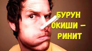 Бурун оқиши – ринит