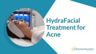 HydraFacial Treatment for Acne