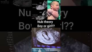 Nub theory boy or girl? #pregnancy #shorts