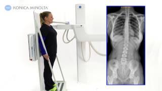Konica Minolta Healthcare KDR Advanced U-Arm Stitching Spine
