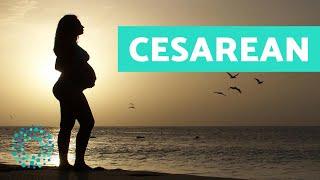 Cesarean CARE and RECOVERY Tips