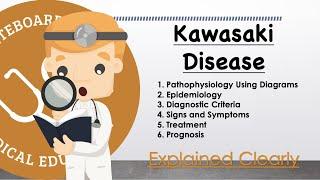 Kawasaki Disease Basics - Pathophysiology, Symptoms, Management, Prognosis | Clinical Medicine