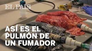 Así se transforma el pulmón de un fumador