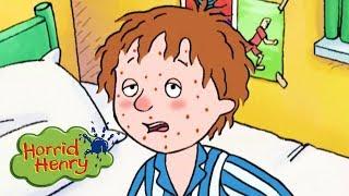 Horrid Henry - Henry Gets Spots | Cartoons For Children | Horrid Henry Episodes | HFFE