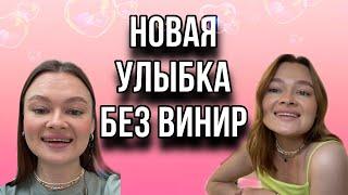 НАРАЩИВАНИЕ ЗУБОВ | БЕЗ ВИНИР  | ЧТО ЭТО | ЦЕНЫ