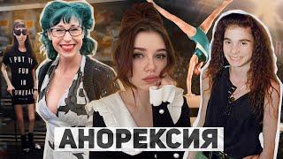 ТИКТОКЕРША УМЕРЛА ОТ АНОРЕКСИИ / Жертвы РПП #2