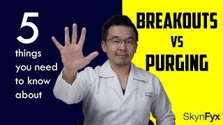 Breakout Vs Purging | 5 things to know