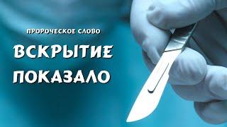 Пророческое Слово: "ВСКРЫТИЕ ПОКАЗАЛО"