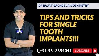 Tips and Tricks Of Single Tooth Implants By Dr. Rajat Sachdeva | Dental Implants Delhi