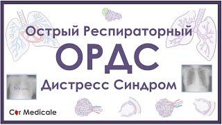 Острый респираторный дистресс синдром - ОРДС - механизм развития, причины, патофизиология